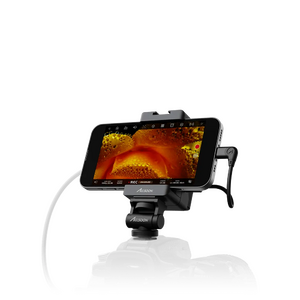 Mobile & Tablet-Based Monitoring